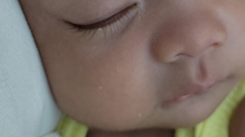 Puti sa mukha ni baby