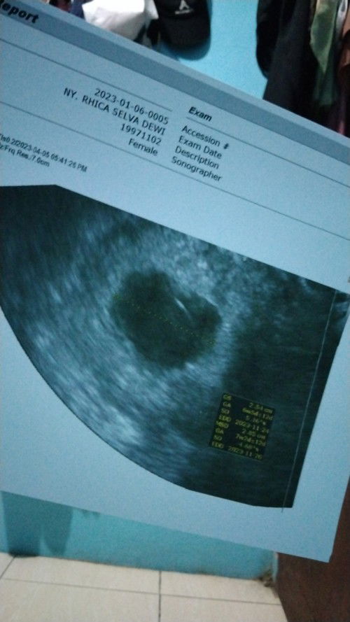 Bund, aku hamil 11w tpi janinnya blm terlihat masih kantong aja,normal ga bund?