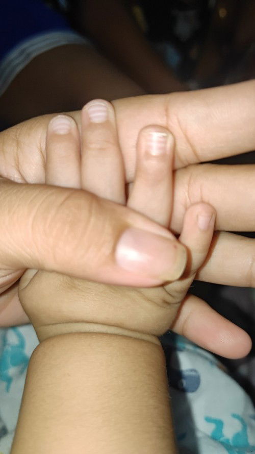 Hi mga mi. Question lang ano po normal po ba na ganyan yung nails ni lo.? 

Thankyou