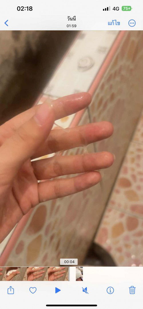 สอบถามคะแบบนี้ใช่มูกก่อนจะคลอดมั้ยคะตอนนี้37+6แล้วค่ะ พอดีปวดท้องอึแล้วพออึเสร็จกำลังล้างก็มีมูกแบบนี้ไหลยืดออกมาค่ะ