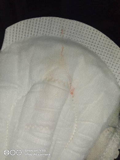 38w keluar lendir+ darah