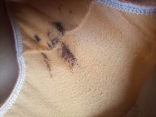 High risk pregnancy! 🥺🤧 Sino po dito ang same case? 7weeks and 5 days napo akong preggy