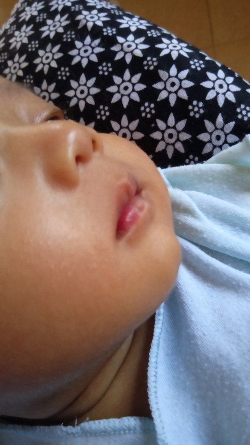 Merah merah di bibir