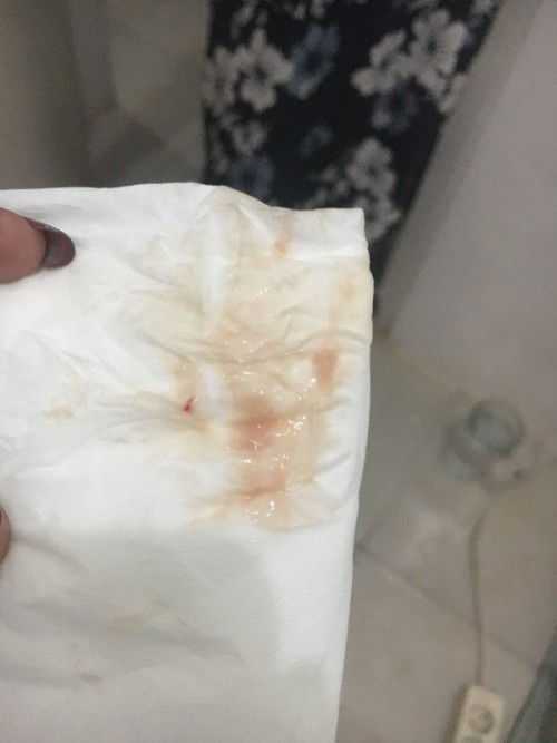 BUN KATANYA KELUAR LENDIR TANDA MAU PERSALINAN TAPI AKU UDAH BEBERAPA KALI KELUAR BELUM KONTRAKSI2?