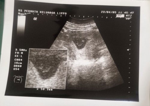 bacanya gmn ini ya bun