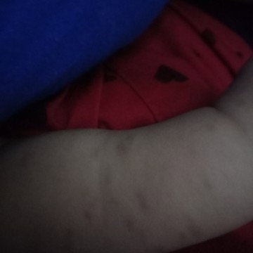 bintik2 hitam