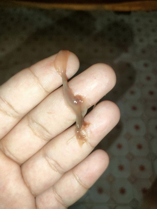 ใช่มูกเลือดไหมค่ะ