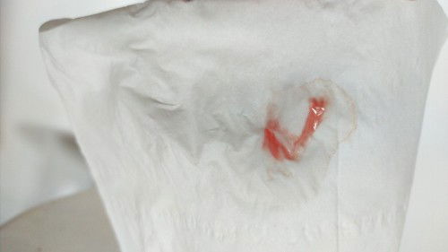 Lendir bercampur darah