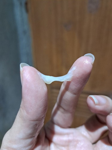 FTM MUCUS PLUG PO BA'TO? 37weeks and 3days