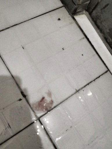 Apakah ini termasuk keguguran