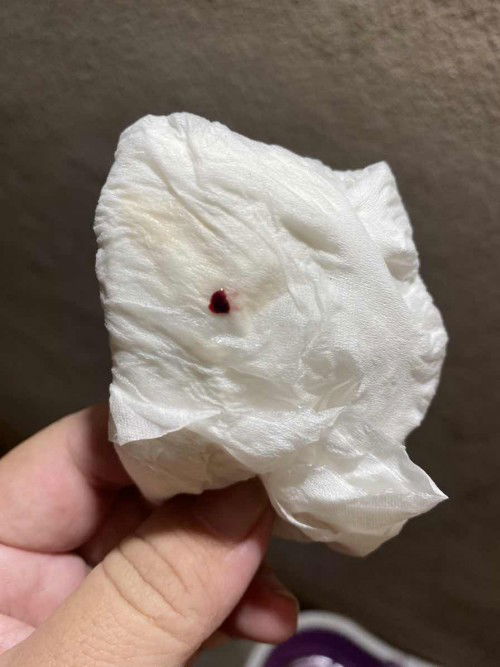 39w1d ท้องแข็งทั้งวัน แต่ไม่ปวดท้อง