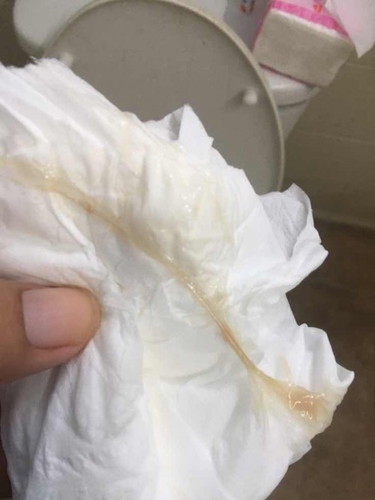 สอบถามเเม่ๆที่มีประสบการณ์หน่อยค่ะ
กี่วันคลอดค่ะ  ขอบคุณค่ะ