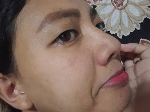 Dry skin after giving birth