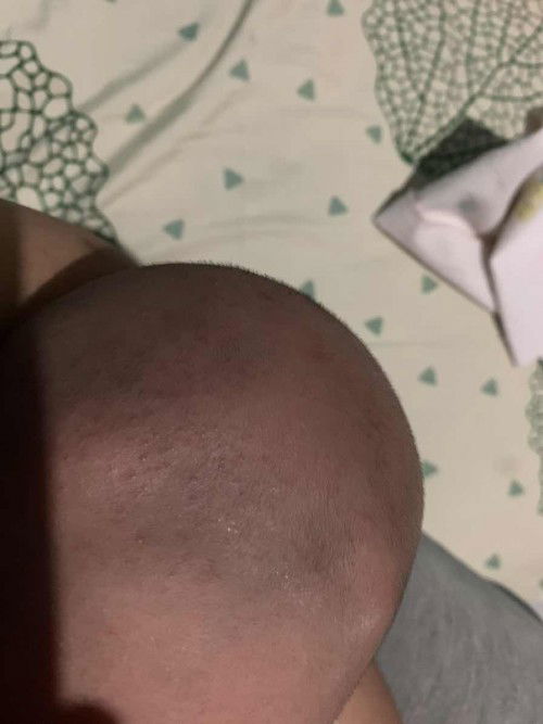 Bintik merah di kepala