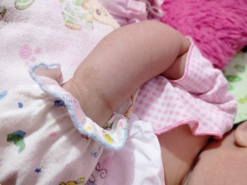 Bercak hitam kering bersisik