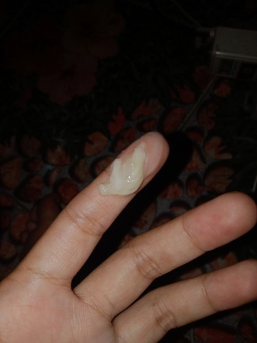 อันนี้คือมูกหรือตกขาวคะ