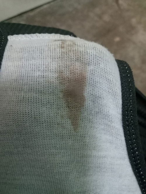 สอบถามมีตกขาวสีออกน้ำตาล แต่ไม่ใช่เลือดนะคะ แปลกไหมคะ