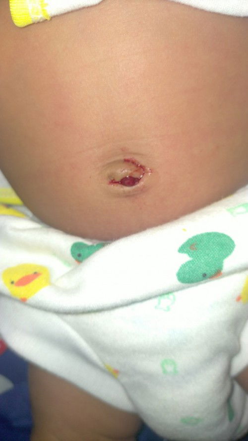 WARNING!! PUSAR BERDARAH