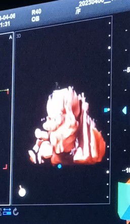 คงจะหลับสบายเนอะ........👶👶