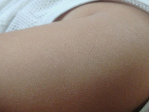 Normal po kaya kahit hindi makita yung marka ng BCG sa arms?