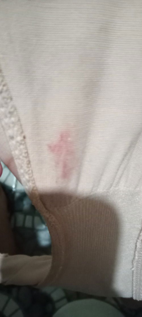 normal lang ba may lumabas ng dugo 39 weeks