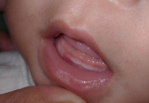 5 months 17 days Teething signs