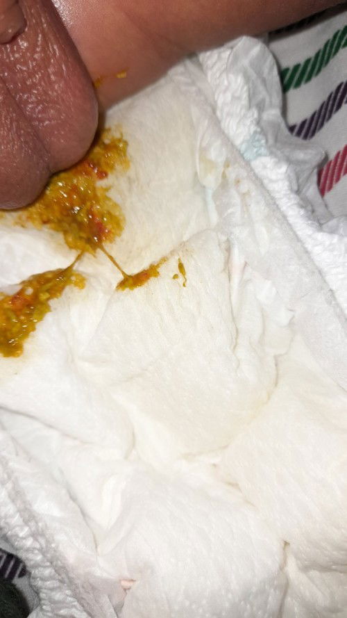 Bab bayi bercak merah