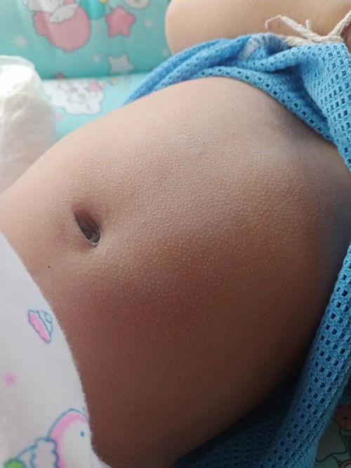 ท้องเด็ก 2 เดือน