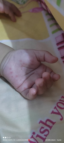 Baka po may makakatulong kung ano po kaya ito asa kamay ng baby ko. Salamat po
