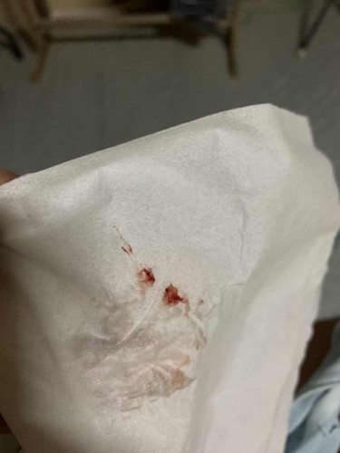 มีแม่ท่านไหนเคยเลือดออกแบบนี้บ้าง