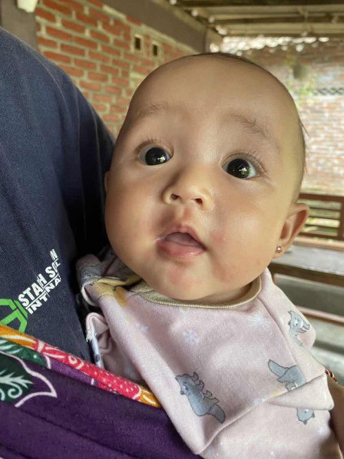 Merah pada area mulut bayi