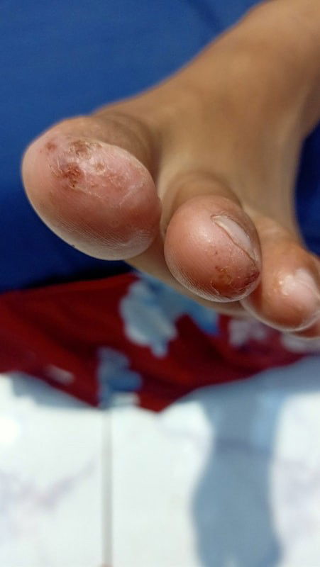 Minta solusinya bund