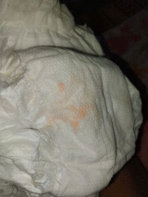 กังวลเกี่ยวกับฉี่ลูก