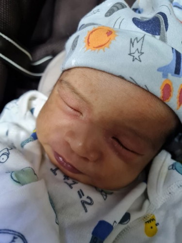 Mga mommy ano kaya tong rashes ng baby ko?