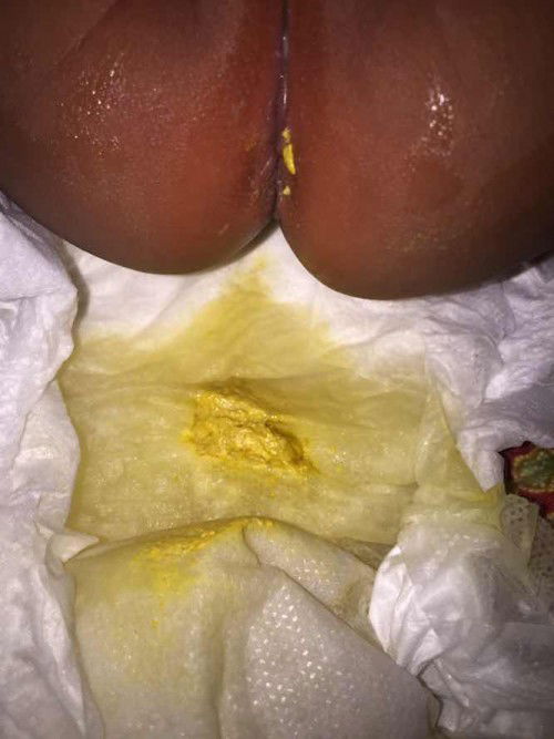 Pertanyaan mengenai najis bayi