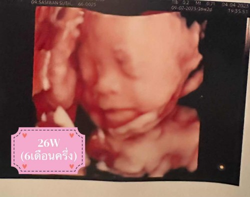 ทีมกรกฎา เห็นหน้าลูกๆชัดกันรึยังคะ เตรียมของคลอดอะไรกันบ้างคะ