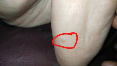 mata ikan anak 1 tahun lebih