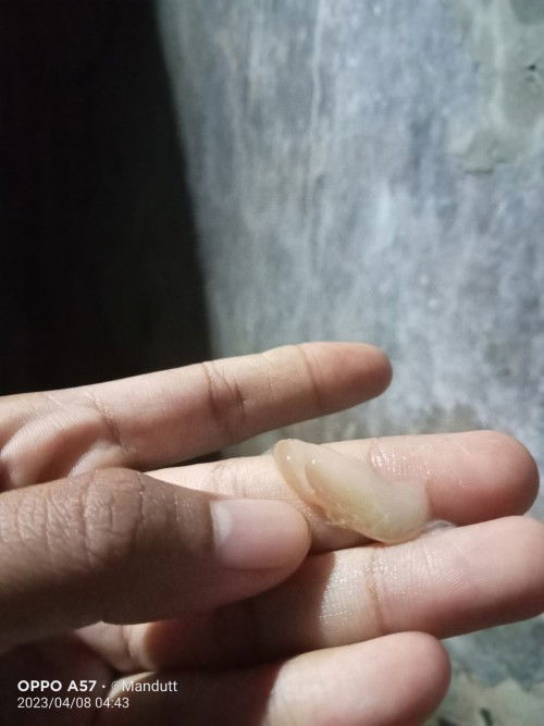 Mempercepat pembukaan