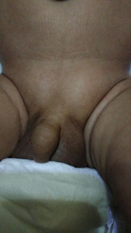 Benjolan saat bayi mengejan