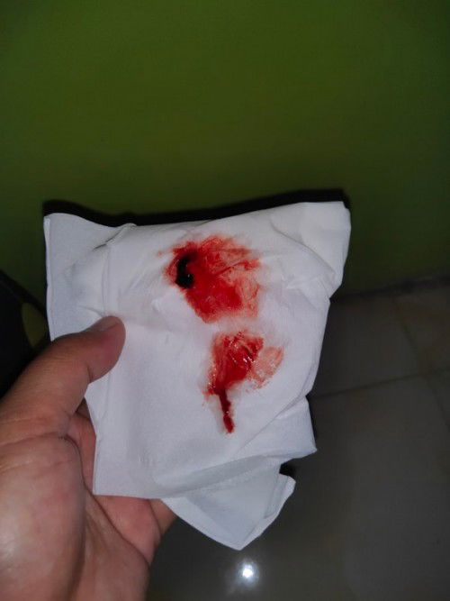 Bun berdarah kaya gini wajar ga bun usia kandungan 39week