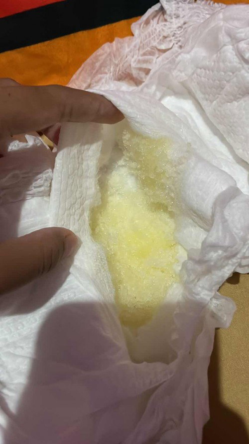 Pipis bayi kuning