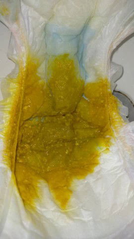 Poo poo baby 3 month