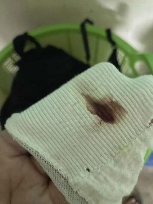 ตั้งครรภ์7เดือนมีเลือดออก