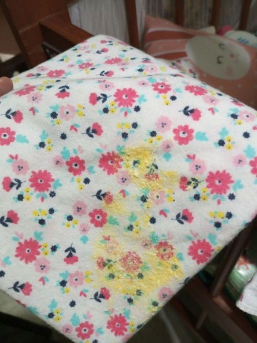 Bayi baru lahir muntah kuning lewat mulut dan hidung