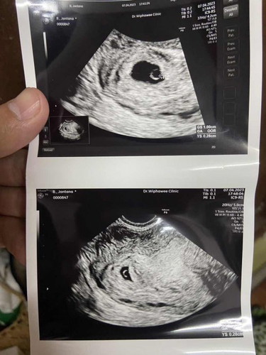 ไปฝากครรภ์ 4-5 Week