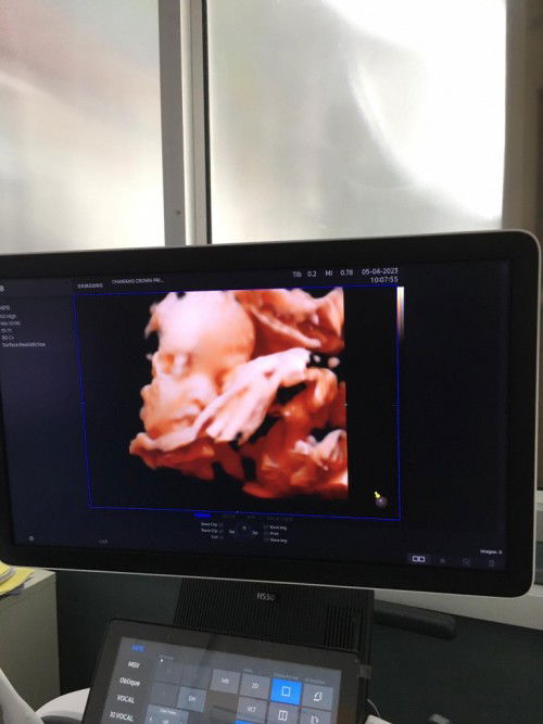 กำหนด10มิถุนายน66 ผมยังไม่มีชื่อเลยครับ