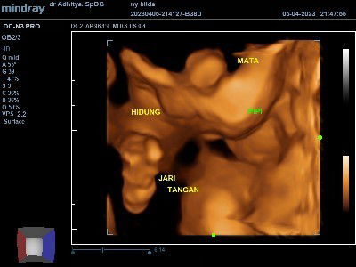 Hpl juni usg nya gimananih? Wajah adek terlihat jelas/gak? 🥰