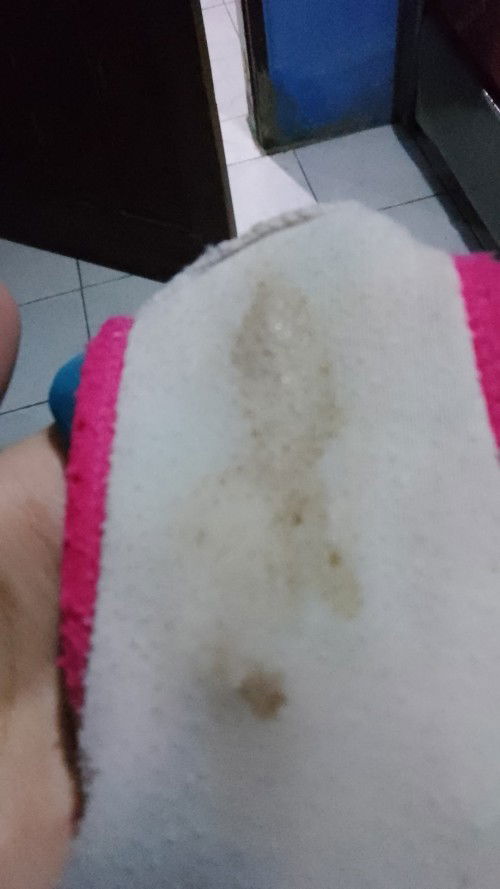 Berbagi pengalaman nya bun