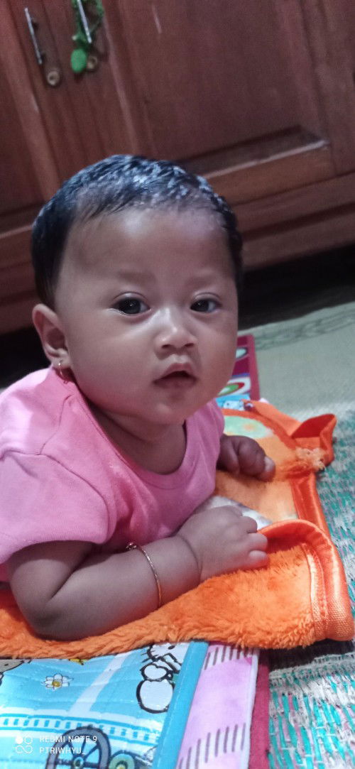 Kelopak mata seperti berbeda