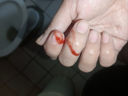 Need ko bang mag pa checkup pagka ganto ang spotting?